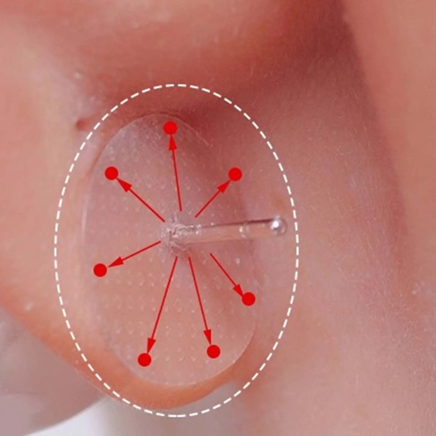 Outus 100Pcs Earlobe Support Stickers for Heavy Earrings Split Ear Protection