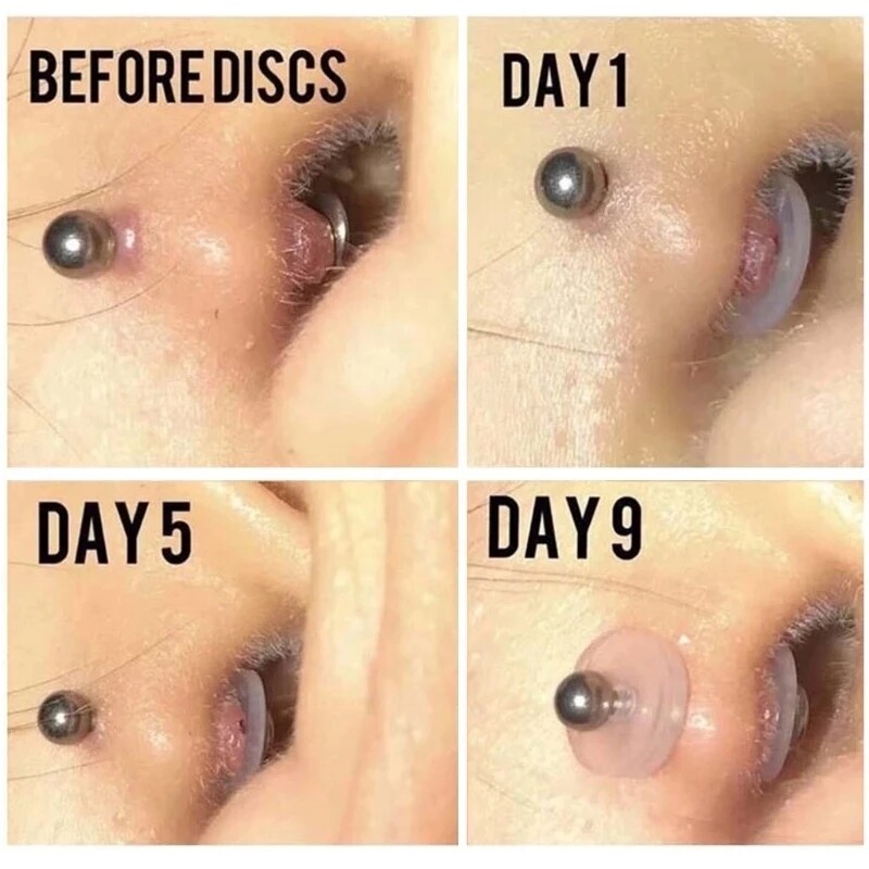 Silicone Piercing Discs Flexible Anti Hyperplasia Saucer for Ear Lip Ring Nose